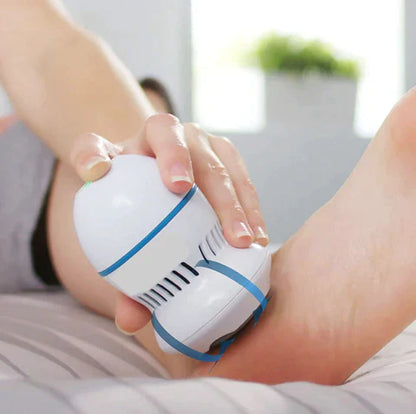 Aloura Vacuum Callus Remover