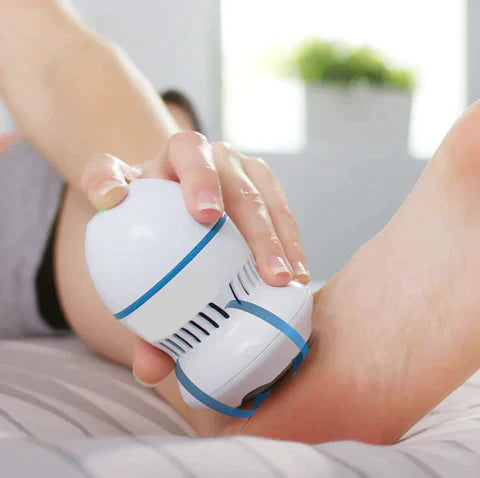Aloura Vacuum Callus Remover
